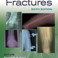 Read ❤️ PDF Handbook of Fractures by  Kenneth Egol MD