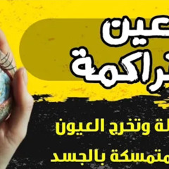 رقية لإخراج العيون المتراكمة والقوية المتكررة ستشعر بسحب جميع العيون