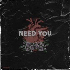 Need you