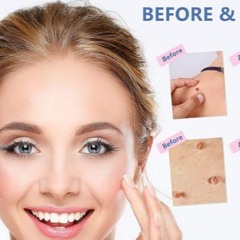 Skin Fix - "Shocking Result" Instant Tag Remover Serum In 2024!