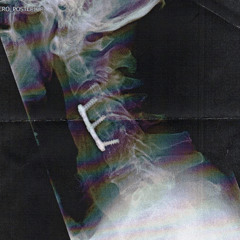 NECK BREAKER FT @ITSREALLYDONJUAN [PROD. SAMMYP]