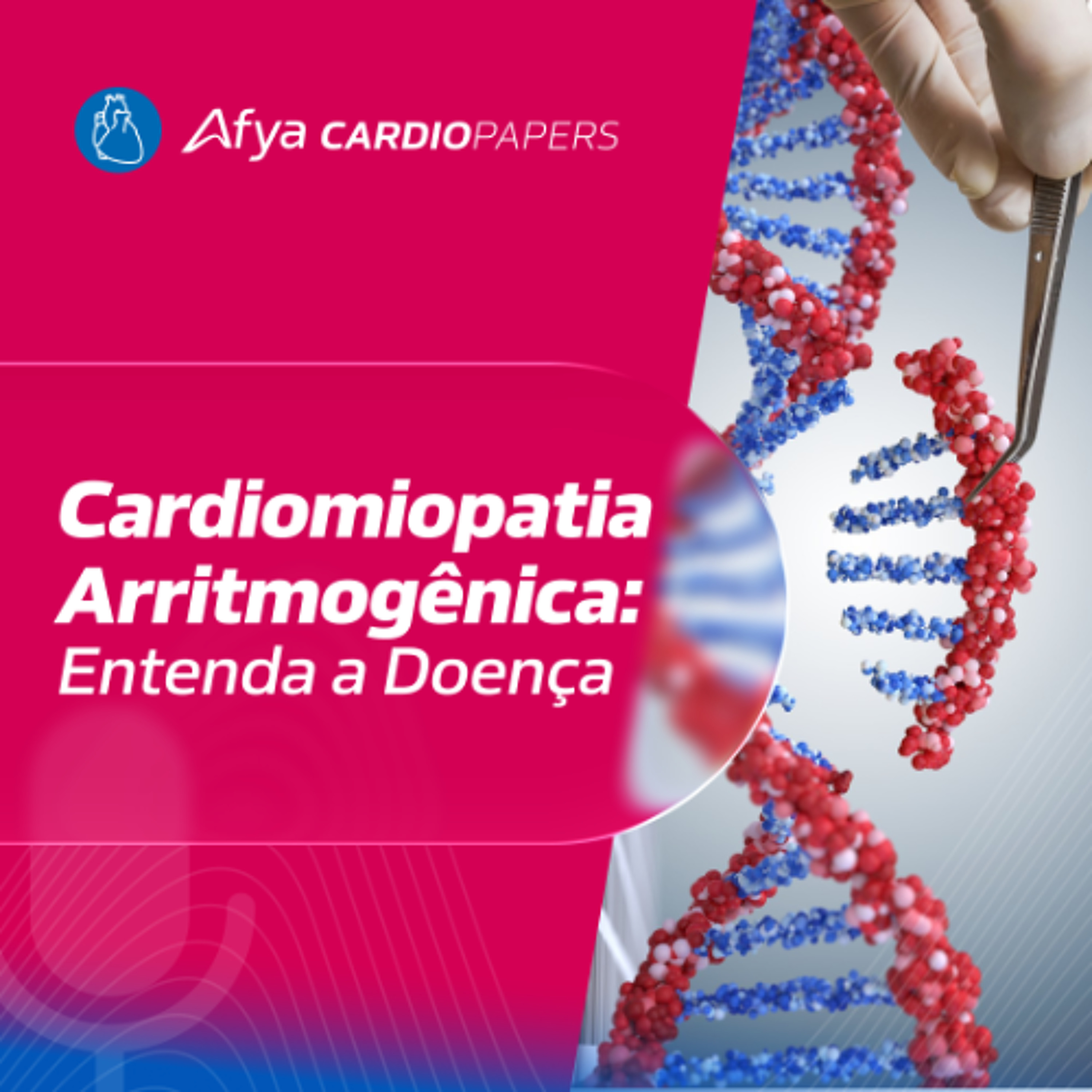Cardiomiopatia Arritmogênica: O que é?