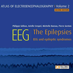READ EPUB 📩 EEG : The Epilepsies: EEG and epileptic syndromes (Atlas EEG Book 2) by