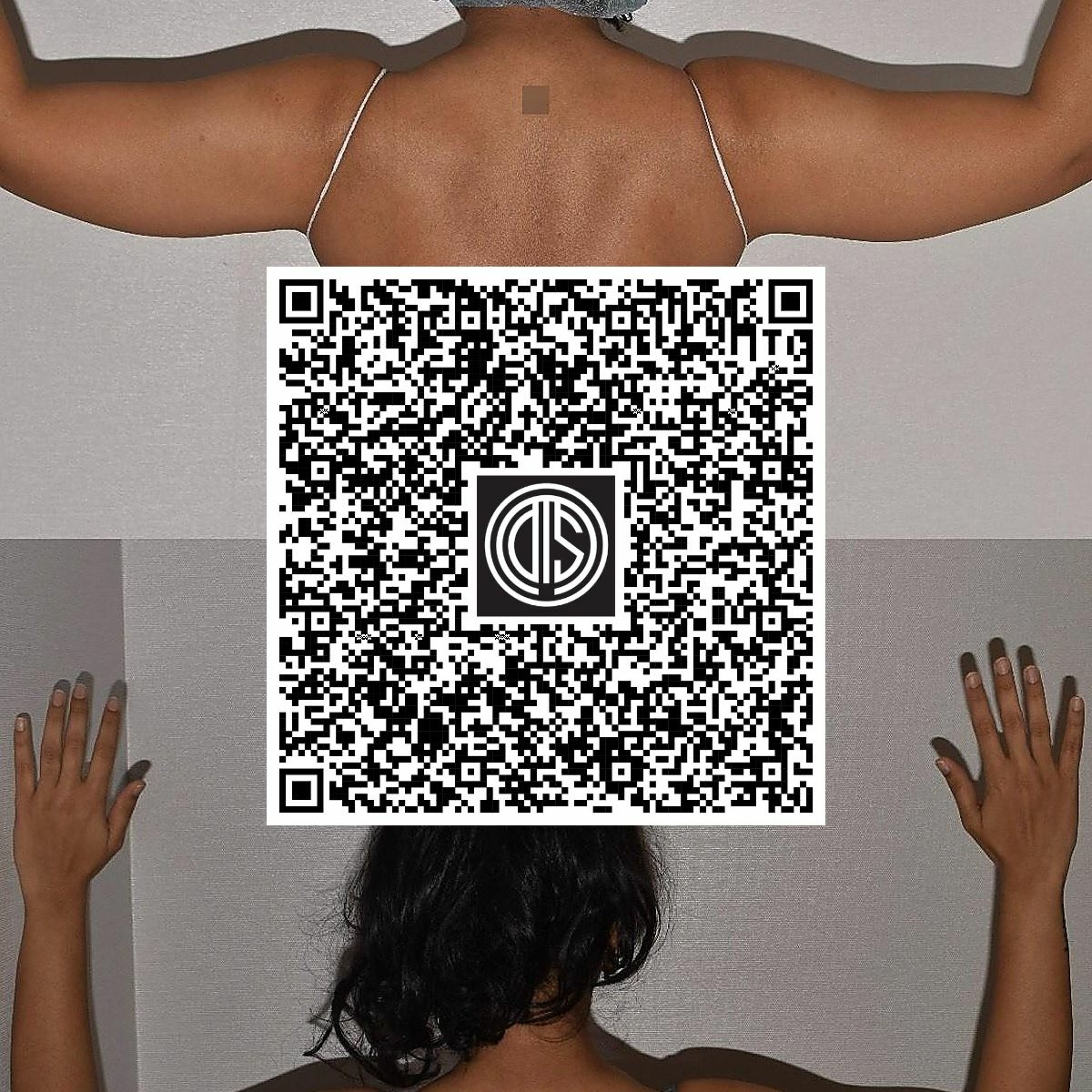 Leading NYC Arm Liposuction near the Bronx, NY episode artwork