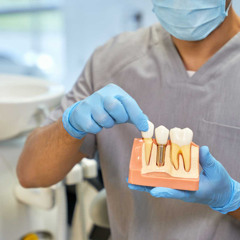 Root canal in Tijuana