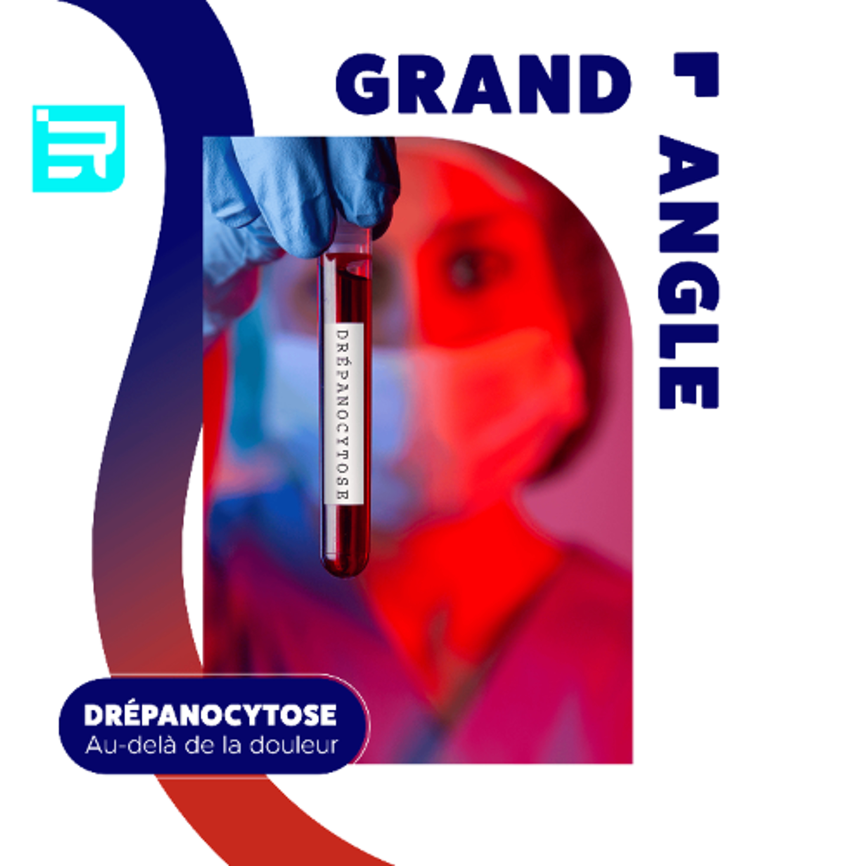 Drépanocytose, au delà de la douleur - Podcast du 16/06 episode artwork
