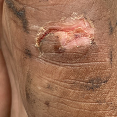 “Power In The DNA OfThe Lamb)TheVocalRemix)"Ft_$quirt916(Mu$ic By:Noined@Voloco App)