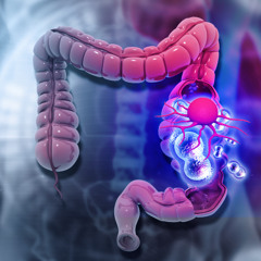 Precision Oncology in Metastatic Colorectal Cancer: A Real-World Case Study