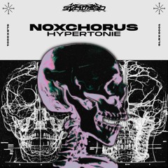 MOTZ Premiere: Nox Chorus - Hypertonie [SLRX0001]