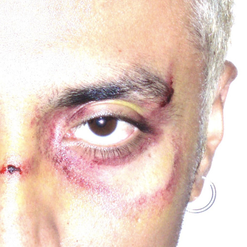 las heridas me las hice yo