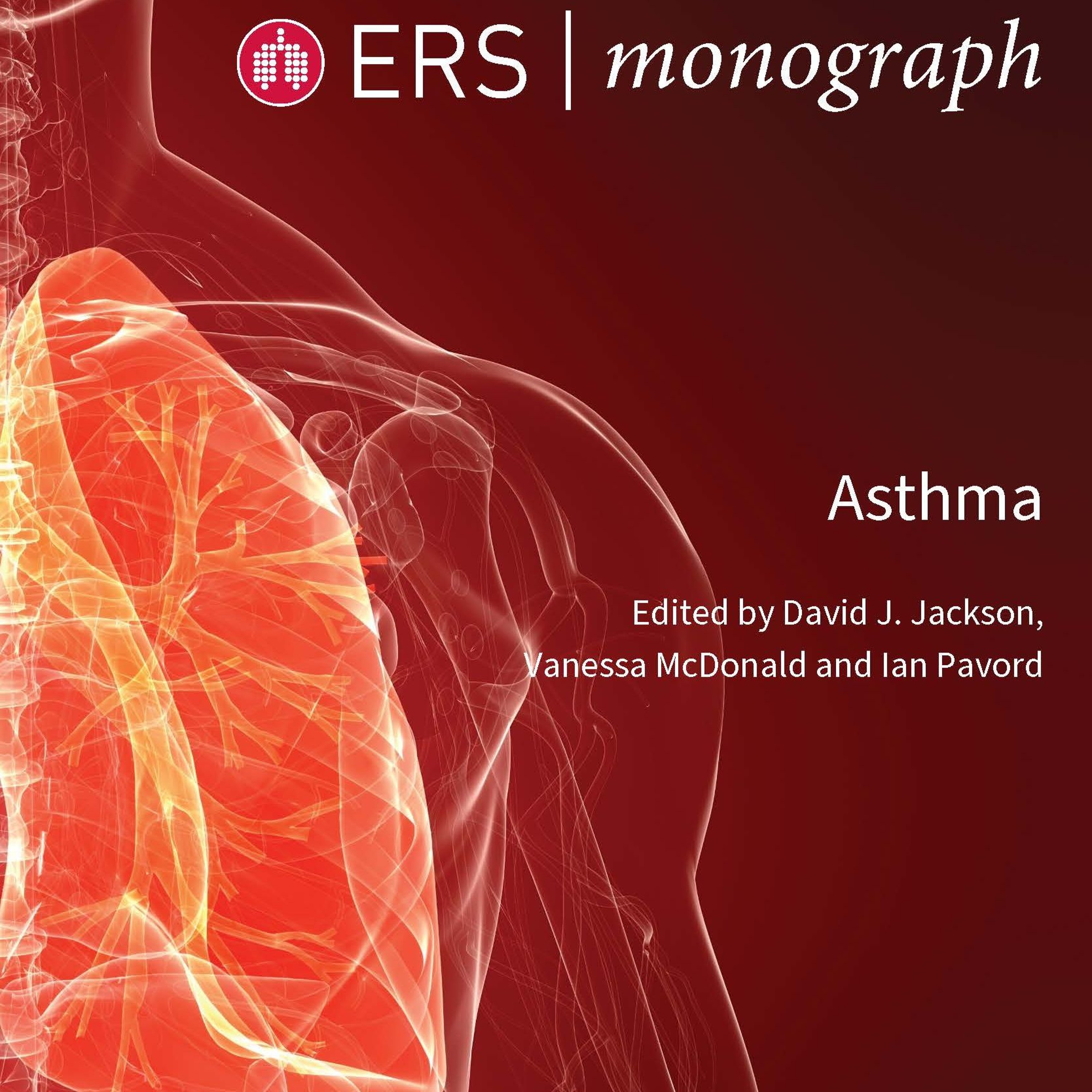 Asthma