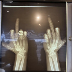 Pàrley (Prod by. Segway)