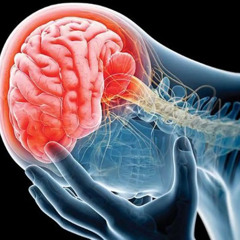 Día Mundial del Derrame cerebral