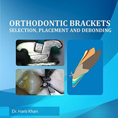 [Read] KINDLE 💏 Orthodontic Brackets: Selection,Placement and Debonding by  Haris Kh