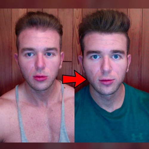 Stream Episode My Current Hair Loss Prevention Regimen By More Plates More Dates Podcast Listen Online For Free On Soundcloud