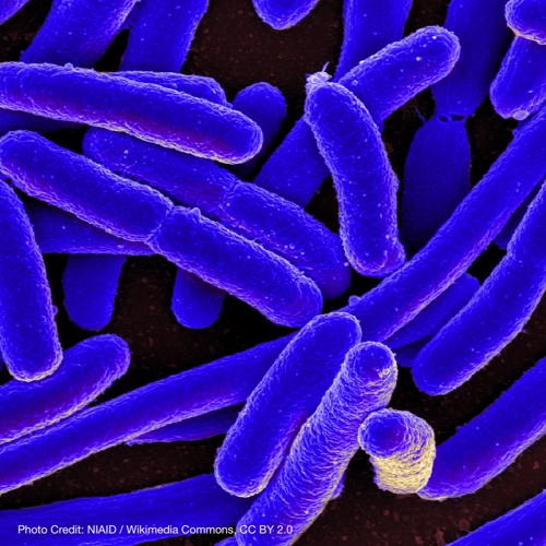 Antimicrobial Resistance - Dr. Rajeev Fernando