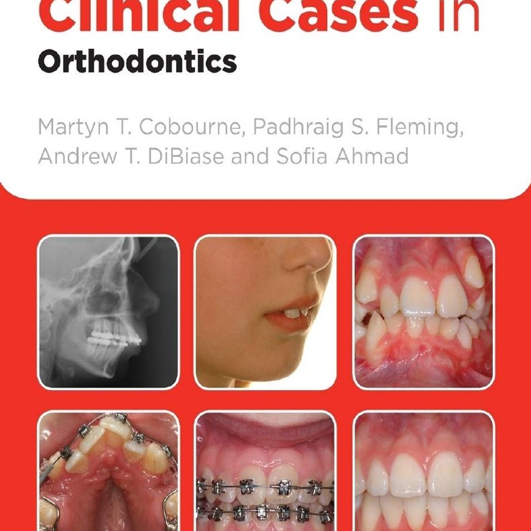 Stream PDF ️Download ️ Clinical Cases in Orthodontics from yuwass ...