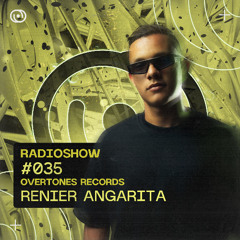 Overtones Radio Show - Renier Angarita Episode 035
