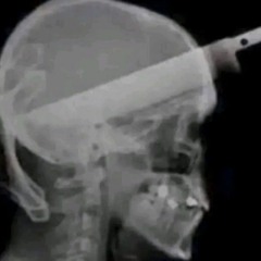 Pain Inside My Head (Mild Headache Reupload)