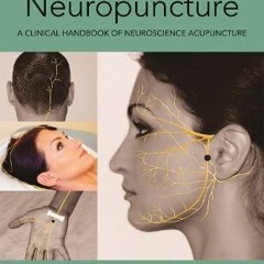 [GET] EPUB KINDLE PDF EBOOK Neuropuncture: A Clinical Handbook of Neuroscience Acupuncture, Second E