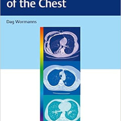 READ EBOOK ✔️ Diagnostic Imaging of the Chest by Dag Wormanns [EPUB KINDLE PDF EBOOK]