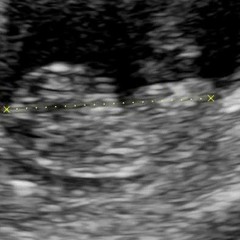 K Bvndz x Big Matic 035 - Soldier(Prod by.Abu On The Beat).mp3