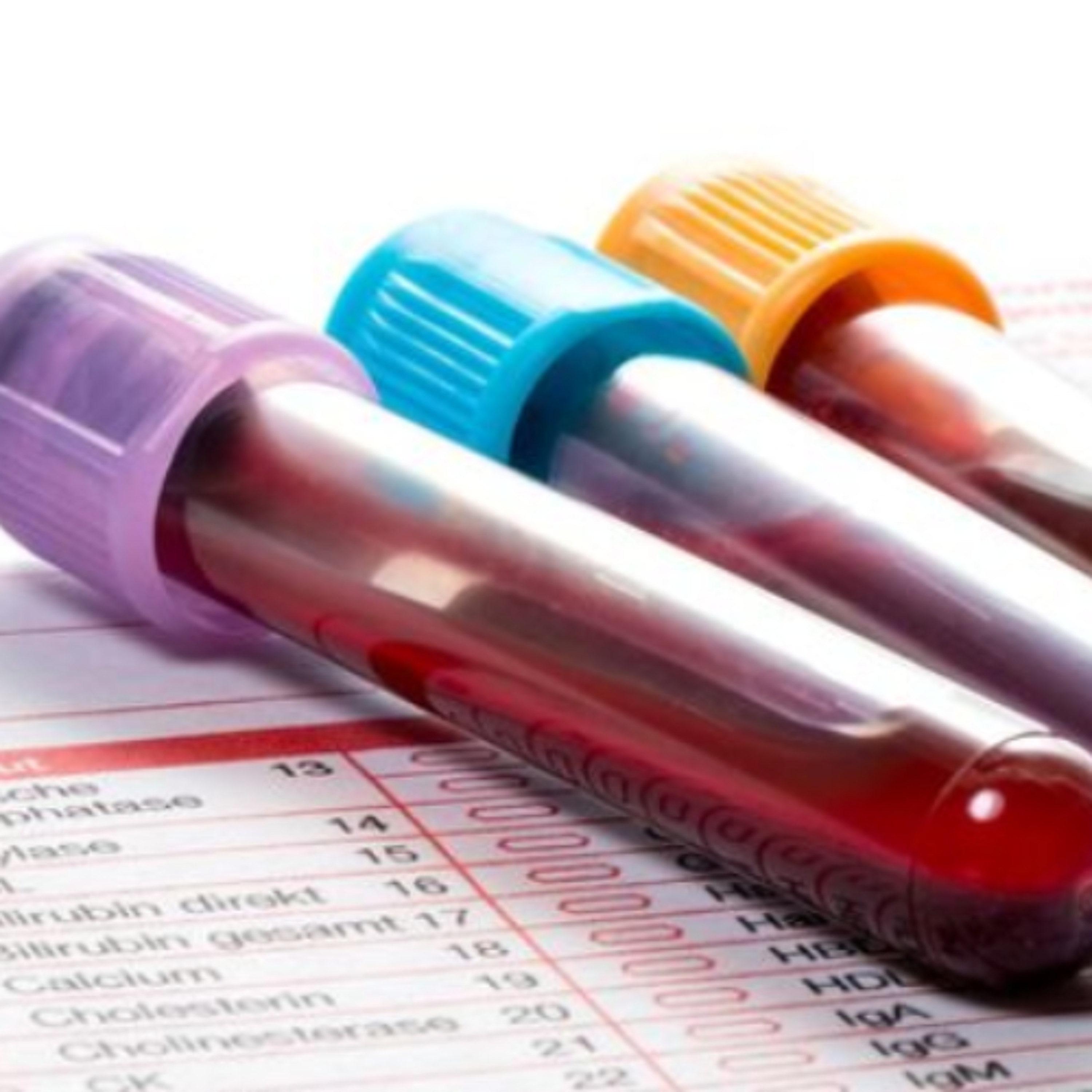 West Clare Nurse Calls For National Haemochromatosis Strategy