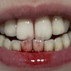 teeth