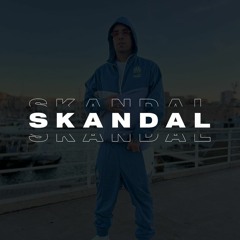 SENTINO - SKANDAL ale to MOCNA VIXA