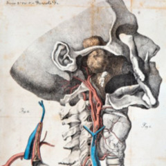 C4 Vertebrae Removal