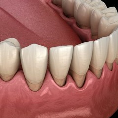 Periodontist in Saskatoon, SK, Canada