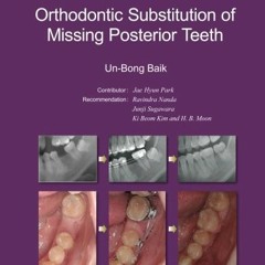 [FREE] EBOOK 💚 Molar Protraction:: Orthodontic Substitution of Missing Posterior Tee