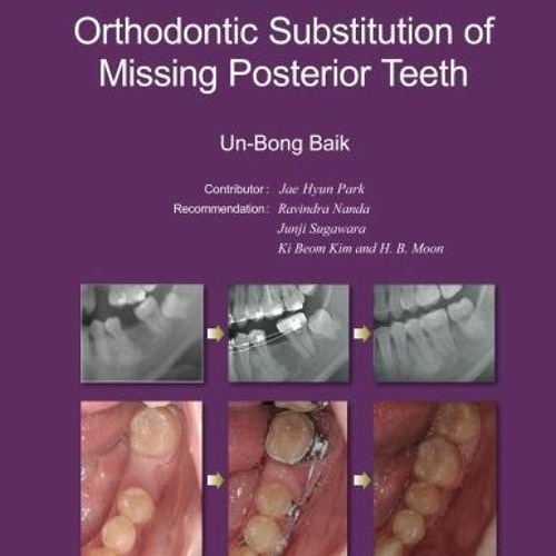 [View] PDF EBOOK EPUB KINDLE Molar Protraction:: Orthodontic Substitution of Missing