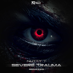 Nutty T - Severe Trauma (Hakka Remix)