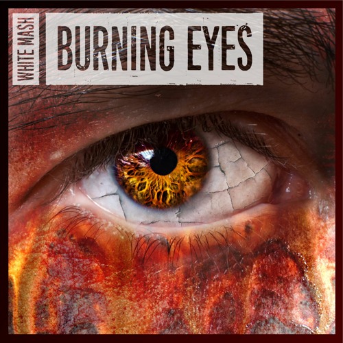 Burning Eyes