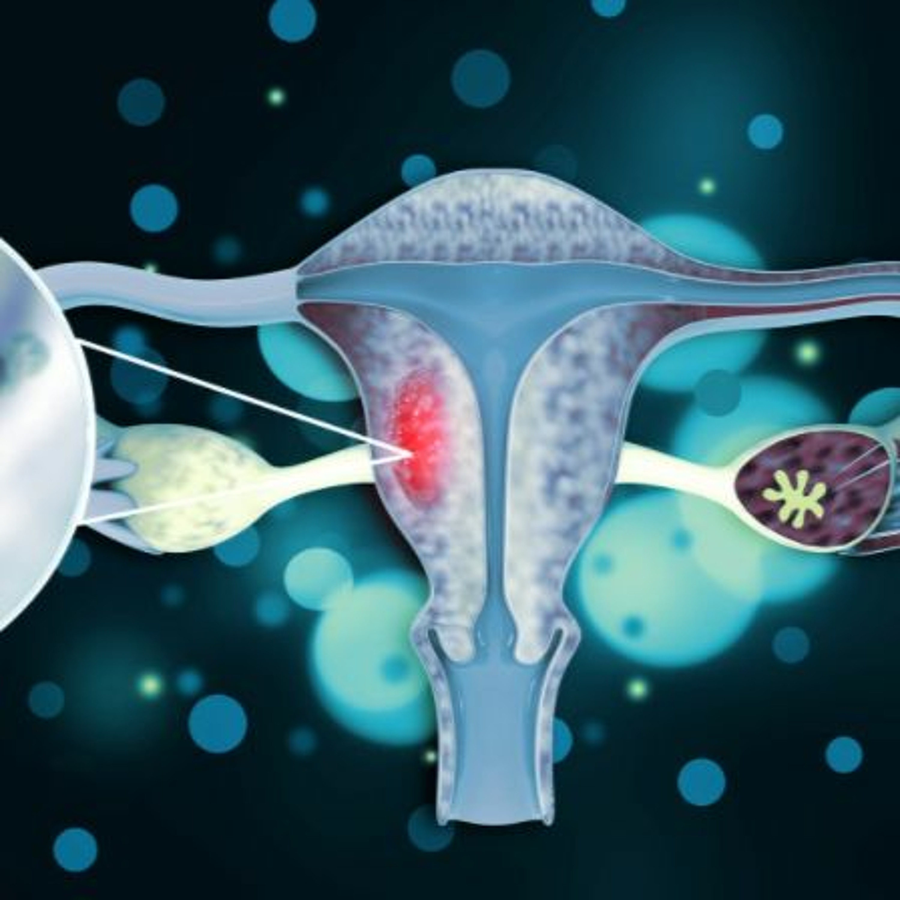 Oncotarget