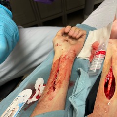 MAKE KETAMINE LEGAL (DOCS DIDN'T EVEN GIVE ME MEDS)