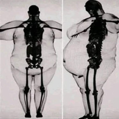 BIG BACK - LOOG X CHOZN #jerseyclub