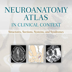 [READ] KINDLE 🖋️ Neuroanatomy Atlas in Clinical Context: Structures, Sections, Syste