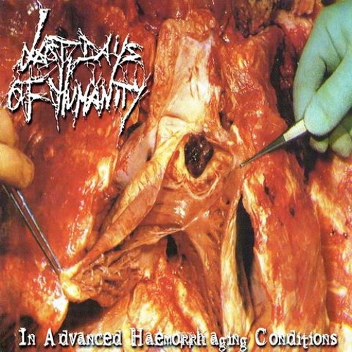 In Advanced Haemorrhaging Conditions