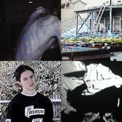 Bones