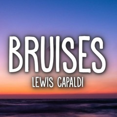Lewis Capaldi - Bruises (Happyland Kaljo/N3ITX ) Remix 2021