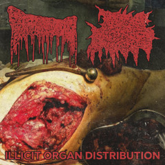 Disseminating Genital Porphyria