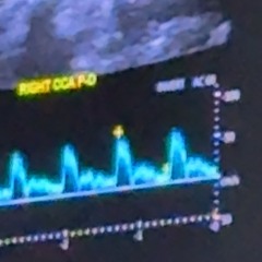 close up(remghost x jolst)