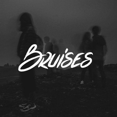 Lewis Capaldi - Bruises (Windeskind Rework)