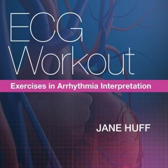 Free EBooks ECG Workout Exercises In Arrhythmia Interpretation TXT