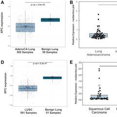 Cigarette Smoke and DNA Repair Deficiency Drive Lung Cancer Development
