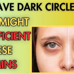 Best Dark Circles Under Eyes Nutritional Deficiency Reviews
