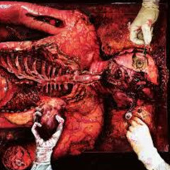EXSANGUINATION (FREE DL)
