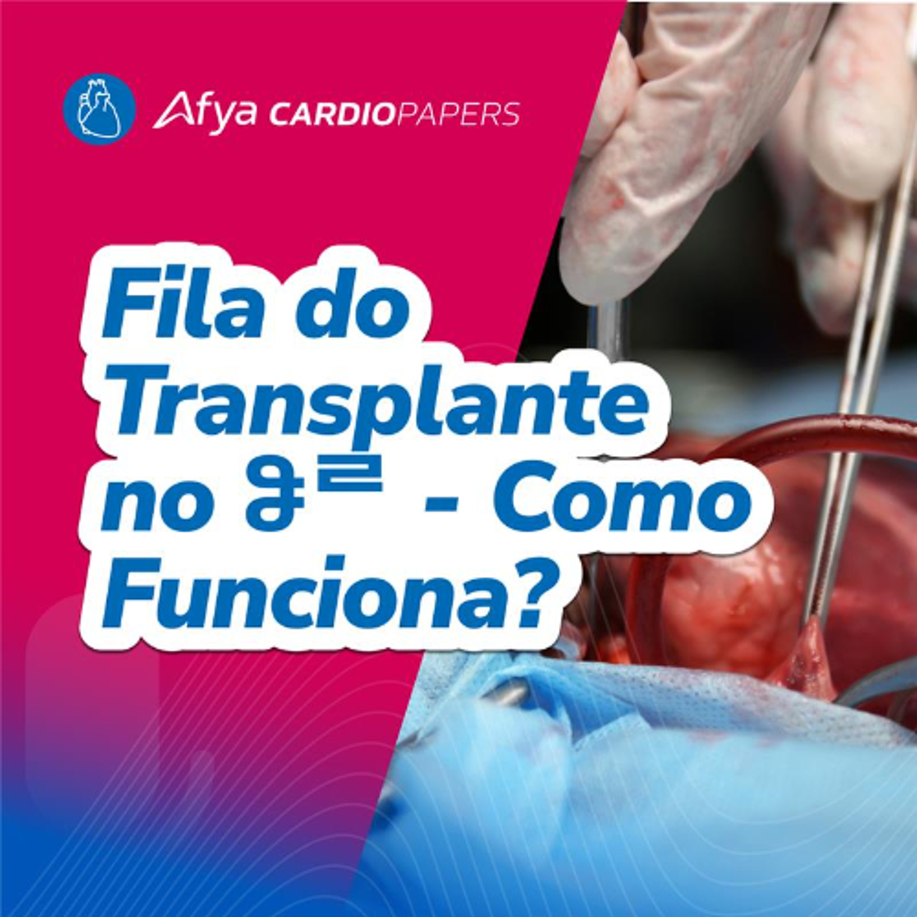 Como funciona a fila do transplante e a escolha do doador ideal? episode artwork